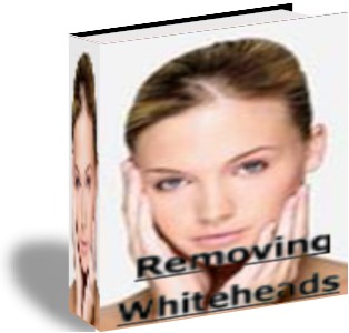 Removing Whiteheads